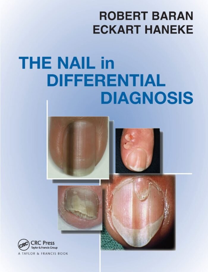 Nail in Differential Diagnosis