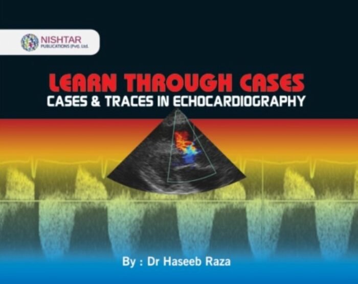 Learn Through Cases Traces in Echocardiography Dr Haseeb Raza